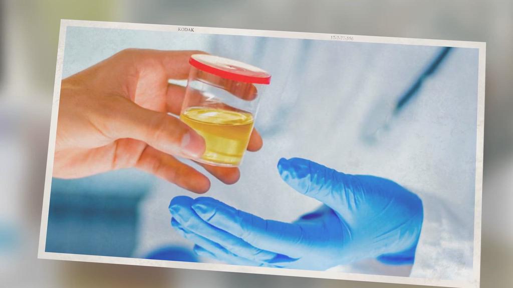 'Video thumbnail for How To Keep Urine Warm For a Drug Test? And Why Is It Important?'